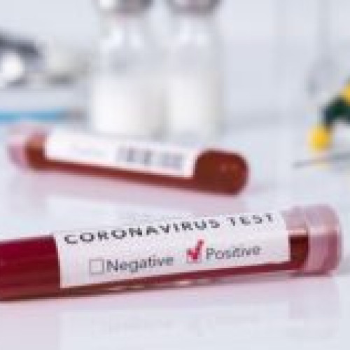 Raportul INSP: Cluj, Prahova, Constanța și Iași printre orașele cu cele mai multe cazuri noi de COVID-19. De atenționat: 8 decese și 560 de cazuri apărute în această săptămână